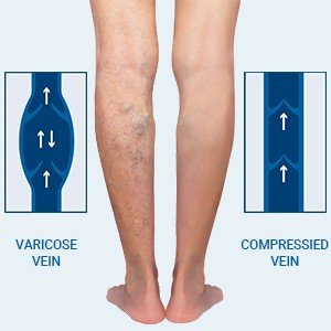 23-32mmHg Microfiber Compression Thigh High Stockings - Image 13